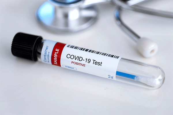 HHS Schedules Free Covid-19 testing periods 
