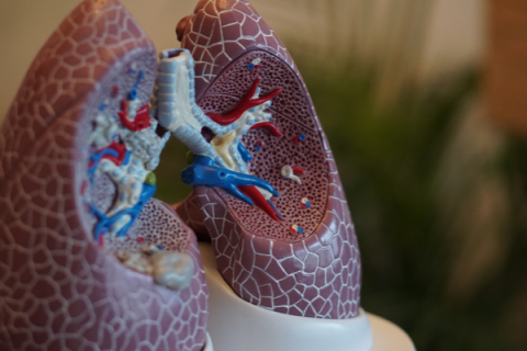 Lung injury cases and deaths associated with e-cigarette product use, or vaping.